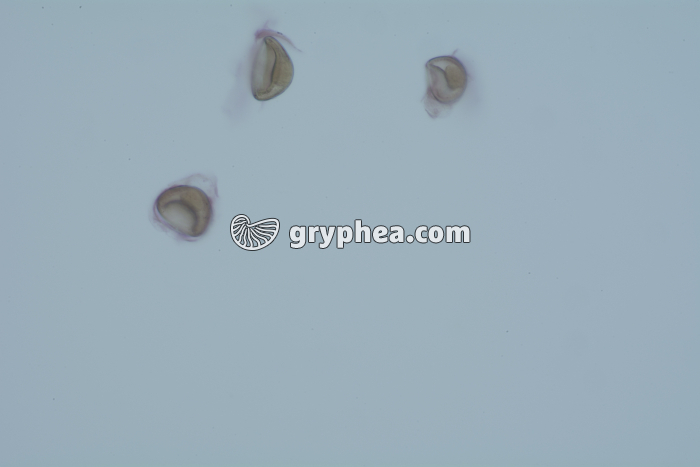 Taenia saginata, oeufs dans déjections x100 - gryphea.org